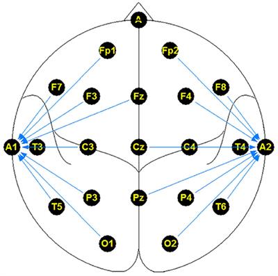 The NMT Scalp EEG Dataset: An Open-Source Annotated Dataset of Healthy and Pathological EEG Recordings for Predictive Modeling